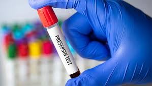 The Presepsin( sCD14) biomarker and early Sepsis Diagnosis and Prognosis in the Emergency Department Lab Tech With Vial in gloved Hand