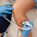 Pros and Cons Using POC D-Dimer Test Diagnosing DVT Deep Leg Vein Scanning